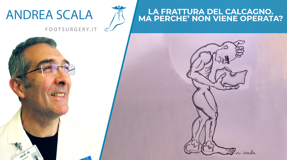 FRATTURA DEL CALCAGNO