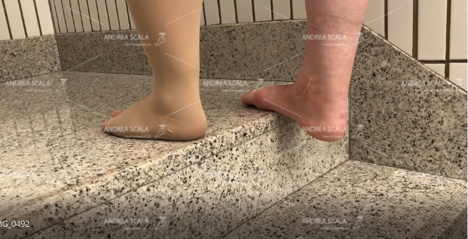Dettaglio del calcagno. Il peso del corpo manda il calcagno molto al di sotto del piano del gradino. Solo così si ottiene l’estensione della caviglia e l’allungamento del tendine d’Achille