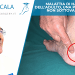 Malattia di Haglund dell'adulto, una patologia da non sottovalutare
