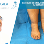 Caviglie gonfie, come ritrovare il benessere
