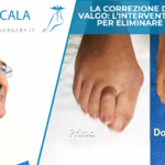 alluce-valgo-operato-dott-andrea-scala.jpeg
