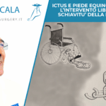 piede equino paralitico