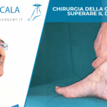 Chirurgia della caviglia per superare il dolore
