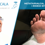 metatarsalgia-dott-andrea-scala