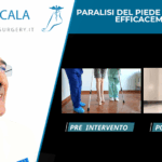 piede-paralitico-cammina-dopo-intervento