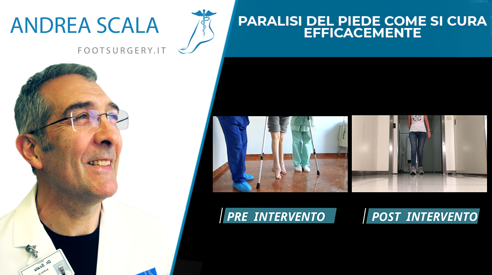 piede-paralitico-cammina-dopo-intervento