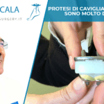 PROTESI DI CAVIGLIA E ARTRODESI