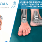 Chirurgia protesi caviglia ok