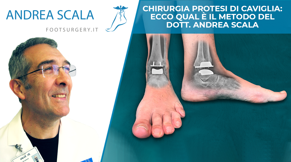 Chirurgia protesi caviglia ok