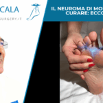 Il Neuroma di Morton