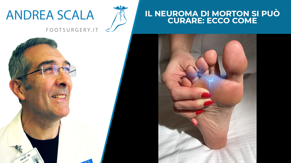 Il Neuroma di Morton