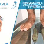 piede piatto valgo pronato.