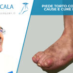 Piede torto congenito