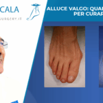 alluce-valgo- prima-dopo- cover