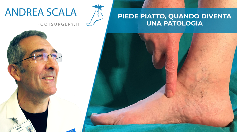 Piede piatto- quando diventa una patologia