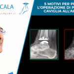 5 motivi per preferire l'operazione di protesi alla caviglia all'artrodesi