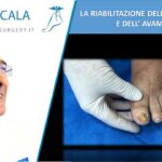 RIABILITAZIONE DELL’ALLUCE E DELL’AVAMPIEDE