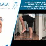 PIEDE EQUINO E PIEDE CADENTE PARALITICO. L’INTERVENTO CHIRURGICO LIBERA DALLA SCHIAVITU’ DELLA MOLLA DI CODIVILLA!